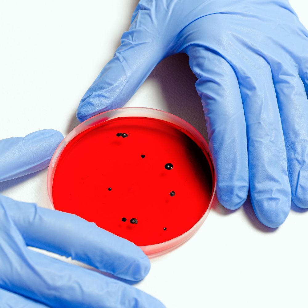 scientist-holding-petri-dish-3786247