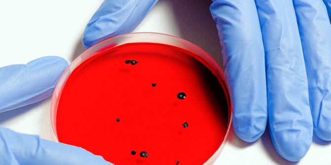 scientist-holding-petri-dish-3786247